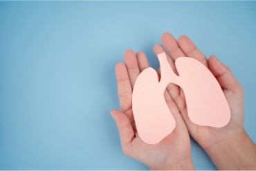 cystic fibrosis